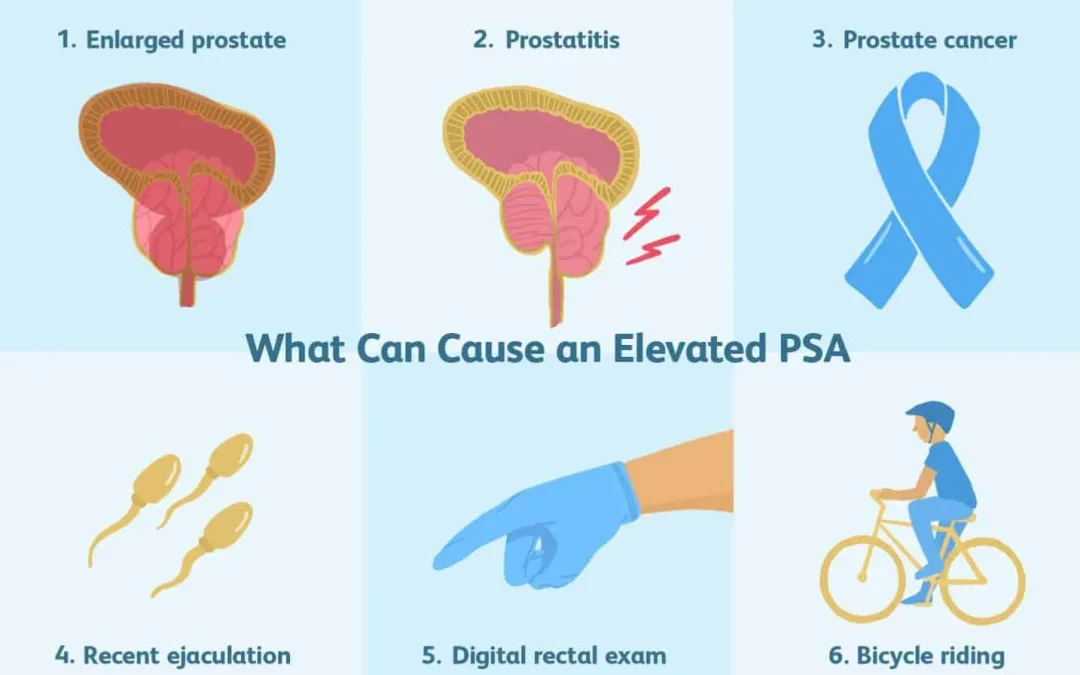 How To Treat Elevated PSA Levels.