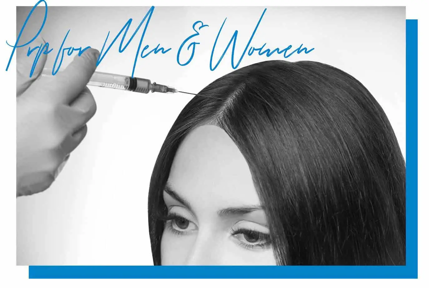 prp-hair-loss-treatment-miami-for-women